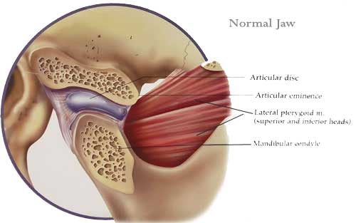 jaw pain